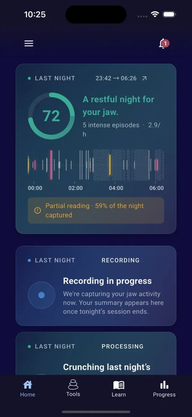 The JawSense app home screen showing last night’s Jaw Score from the sensor